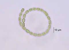 Anabaena