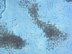 Microcystis