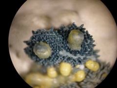 Hypocrella disciformis