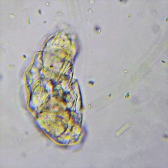 Lecane inermis