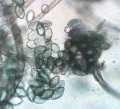 Botryotrichum murorum