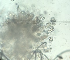 Botryotrichum murorum