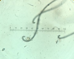 Botryotrichum murorum