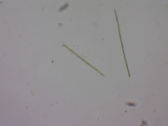 Planktothrix