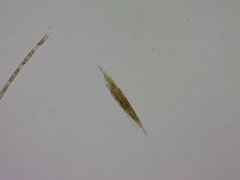 Aphanizomenon flosaquae