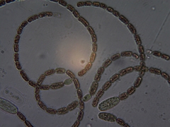 Anabaena