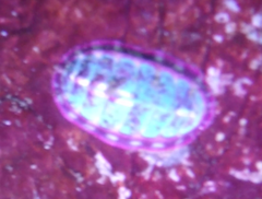 Tonicella