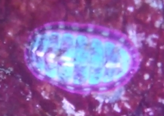 Tonicella