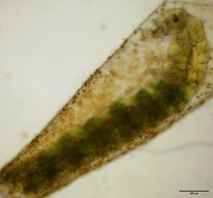 Oxyethira