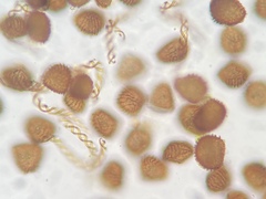 Fossombronia wondraczekii