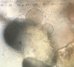 Chytridiomycota