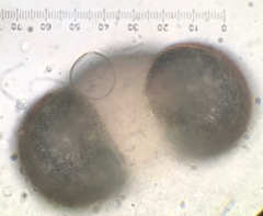 Chytridiomycota