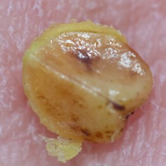 Cotoneaster adpressus