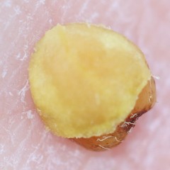 Cotoneaster adpressus