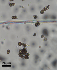 Calicium lenticulare