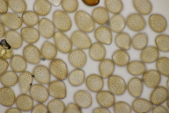 Uromyces appendiculatus