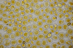 Puccinia oxalidis
