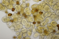 Gymnosporangium sabinae