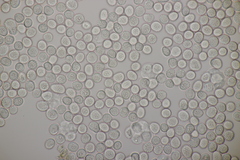 Microbotryum scabiosae