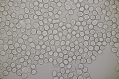 Microbotryum scabiosae