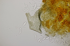 Ophiognomonia leptostyla