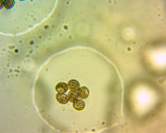 Fuligo septica rosea