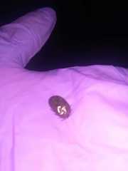 Rhipicephalus microplus