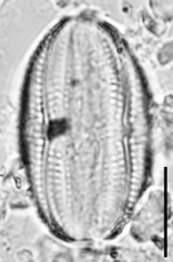 Amphora copulata