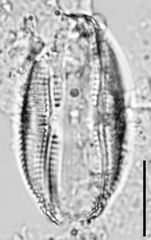 Amphora copulata
