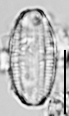 Amphora