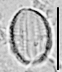 Amphora