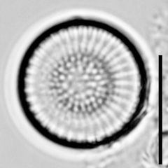 Cyclostephanos dubius