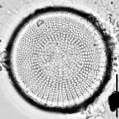 Stephanodiscus neoastraea