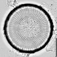 Stephanodiscus neoastraea