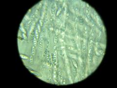 Lentomitella magna