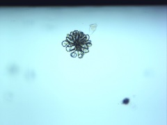 Dolichospermum lemmermannii