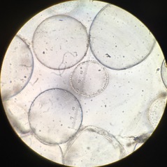 Coprinopsis stercorea