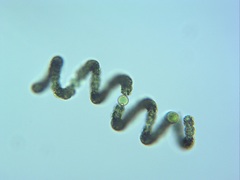 Dolichospermum crassum