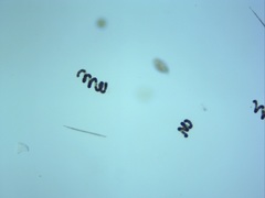 Dolichospermum crassum