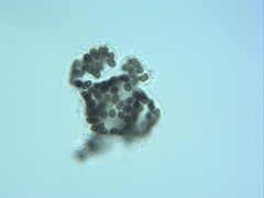 Microcystis wesenbergii