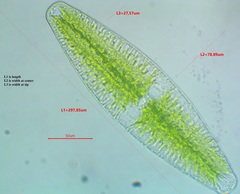 Netrium digitus