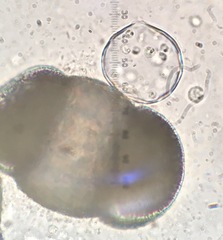 Chytridiomycota