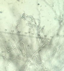 Scopulariopsis