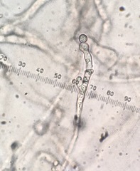 Scopulariopsis