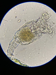 Philodina megalotrocha