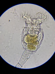 Philodina megalotrocha