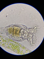 Philodina megalotrocha