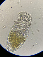 Philodina megalotrocha