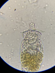 Philodina megalotrocha