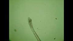 Aeolosoma